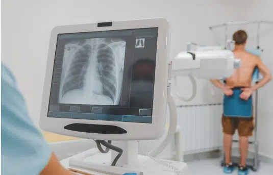 View of digital chest xray with man in the background