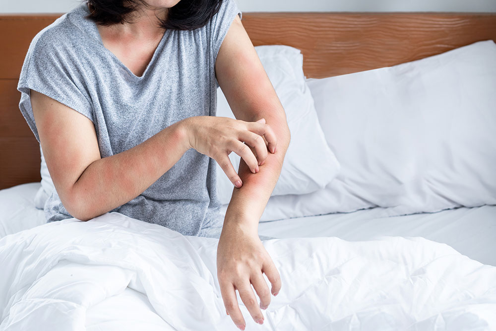 A closeup of a woman sitting in bed scratching a rash on her arm.